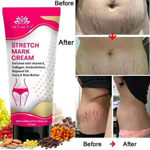 INTIMIFY Stretch Marks Removal Cream 50g
