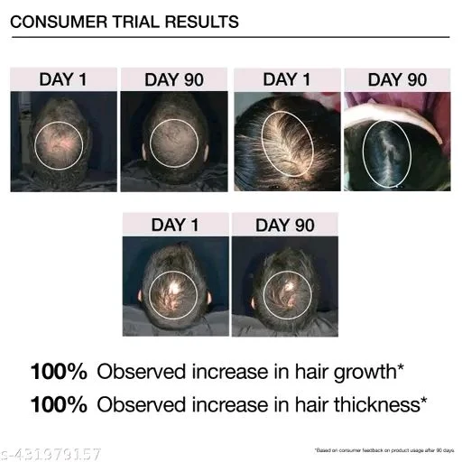 SOULFLOWER Rosemary Hair Growth Serum 30ml