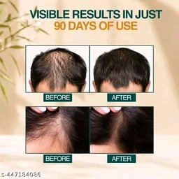 NOURISH MANTRA Hair Growth Serum 25ml