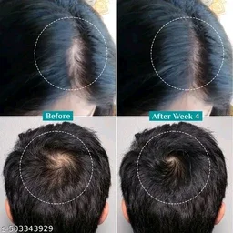 PILGRIM Advanced Hair Growth Serum - Pack Of 2 X 50ml