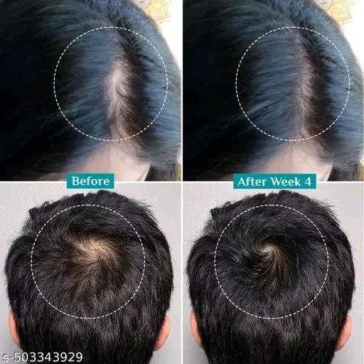 PILGRIM Advanced Hair Growth Serum - Pack Of 2 X 50ml
