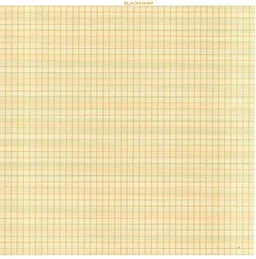 FAIRBIZPS ECG Paper Roll 215mm x 18m - Pack of 2 | Pink Rectangular Thermal Chart Roll | Compatible with Bionet ECG Machine - 215mm x 18m