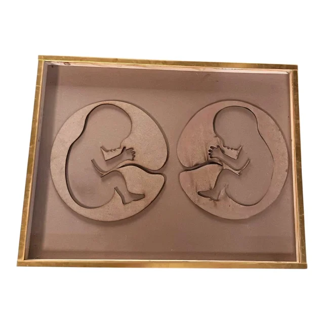 Twin Baby Preservation Frame With Golden Border - 16 * 10 * 1 inches