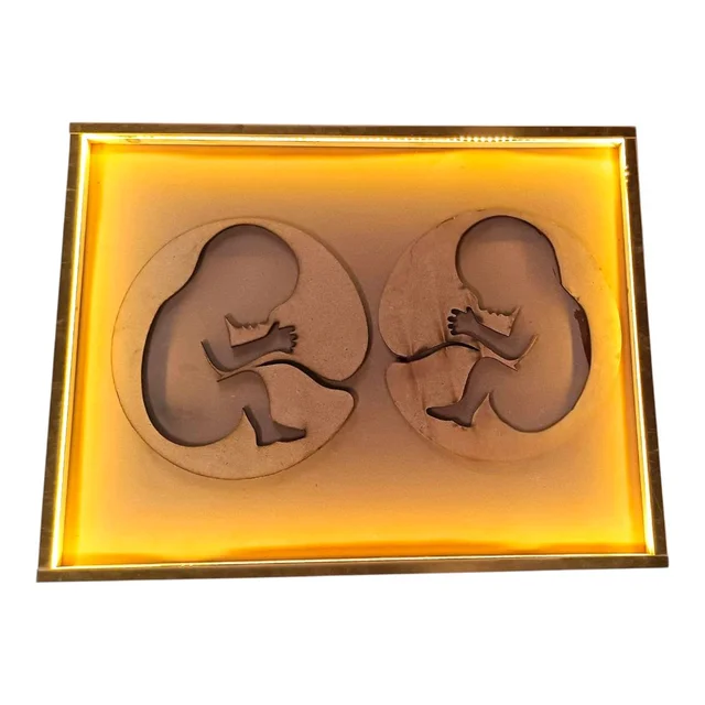LED Twin Baby Preservation Frame With Gold Border - 16 * 10 * 1 inches