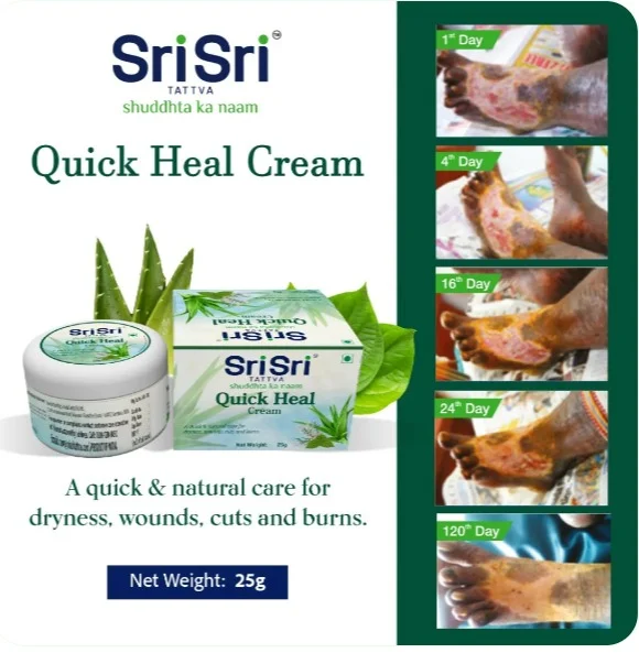 Sri Sri Tattva Quick Heal Cream - 25gm