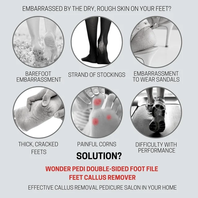 Dual Sided Foot File – Effective Dead Skin Removal & Smoothing