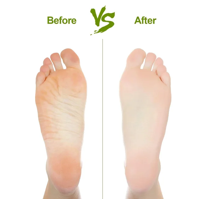 Foot Pumice Stone – Rectangular Dead Skin & Callus Remover
