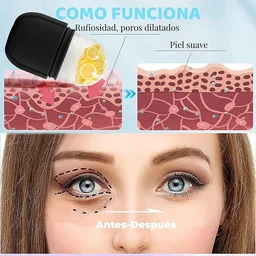 Ice Roller for Face – Reusable Facial Massager & Eye Relief | GlowForm