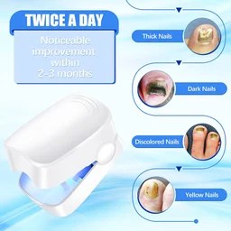 Nail Fungus Laser Treatment – Rechargeable Device for Hands & Feet | AuriGlam