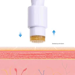 Derma Stamp 1.5 MM With Titanium Needles For Acne Scars, Wrinkles,Hair Regrowth - 1.5 mm, White