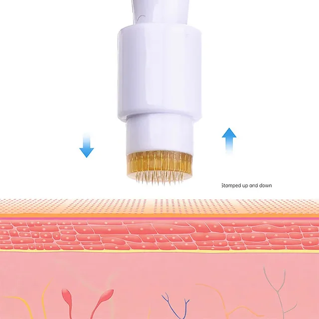 Derma Stamp 1.5 MM With Titanium Needles For Acne Scars, Wrinkles,Hair Regrowth - 1.5 mm, White