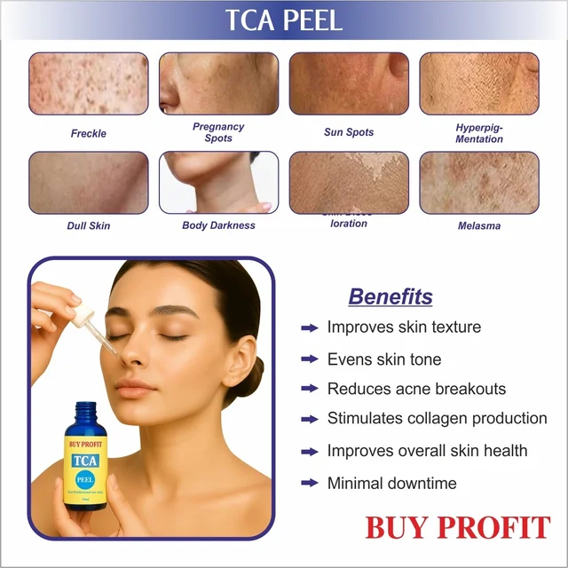TCA 15% CHEMICAL Peel At HOME For Scars, Dark spots, Pigmentation, Peeling Etc