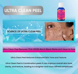 Aa Ultra Clean Peel For Tca Cross Marks Dark Spots, Hyper Pigmentation, Melasma etc