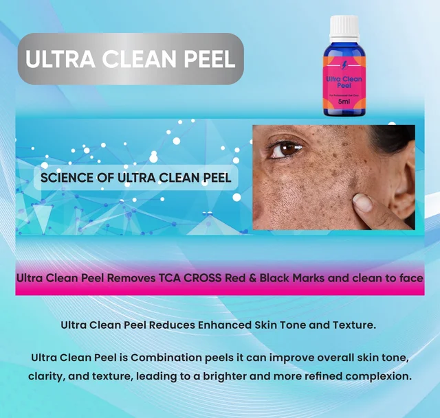 Aa Ultra Clean Peel For Tca Cross Marks Dark Spots, Hyper Pigmentation, Melasma etc