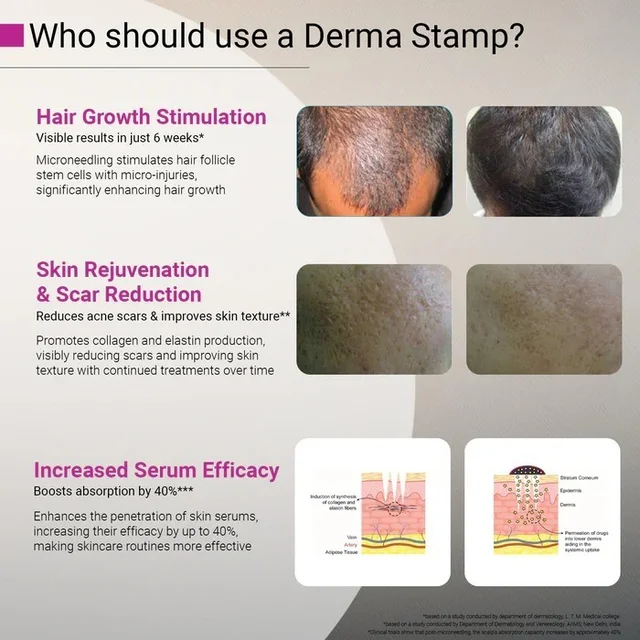 Derma Stamp Adjustable Pen 0mm - 3mm,100 A Titanium micro needles I Amazing Professional Microneedling Pen for Skin Repair, Face, Hair & Beard Growth I Easy to use I Safe and Effective - 0.25 mm to 3.00mm, white