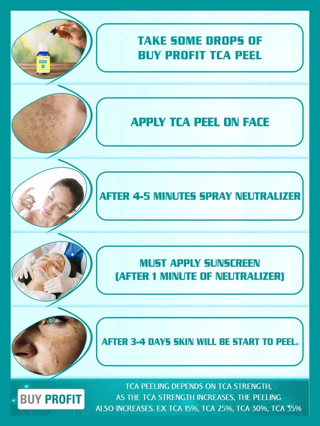 TCA 15% CHEMICAL Peel At HOME For Scars, Dark spots, Pigmentation, Peeling Etc