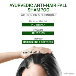 SESA Ayurvedic Hair And Scalp Medicine Anti Hair Fall Shampoo With Bhringraj And Onion 