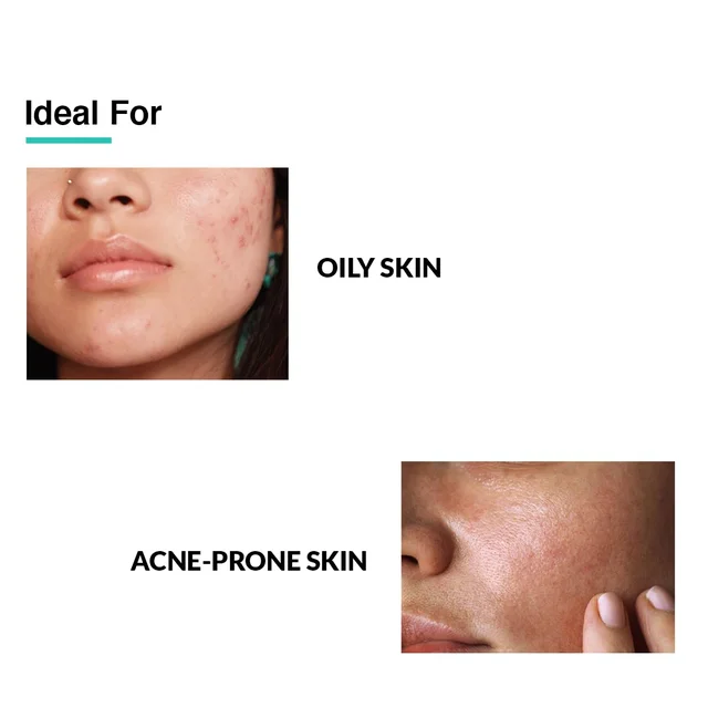 Fixderma 2% Salicylic Acid Serum 30g | With 5% Azelaic Acid & 4% Mandelic Acid | Anti-Acne & Spot Treatment | Controls Oil, Clears PoresFace Serum for Men & Women