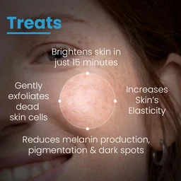 Fixderma Cosmetics Laboratories Fixderma Cosmetic LaboratoriesBrightening Face Mask 100gm| Kojic Acid Mask With Hyaluronic Acid | PHA, BHA & AHA Exfoliates Dead Skin, Tightens Pores & Boosts Glow