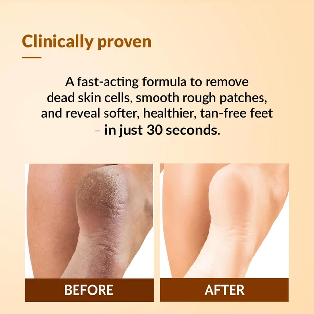 Fixderma Foobetik Foot Scrub Spray 50ml | 30 Sec Foot Facial Spray with Lactic Acid | Removes Dead Skin & Callus | Heel Softening Instant Smooth Feet SprayFoot Care for Men & Women
