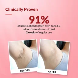 Fixderma Nigrifix Underarm Velvet Musk Roll On 60ml with 6% AHA, Lactic Acid, 1% Mandelic Acid & Kojic Acid | Brightens, Exfoliates & Smoothens Dark Underarms | Sensitive Skin Safe