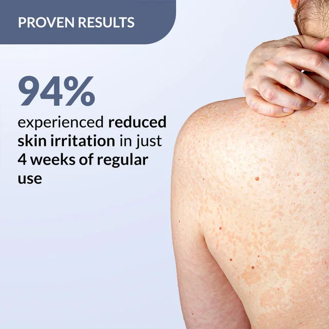 Fixderma Salyzap 2% Salicylic Acid Body Acne Spray For Men & Women 50ml | Targets Back, Shoulder, Neck & Chest Acne | Controls Breakouts, Clears Clogged Pores & Improves Texture