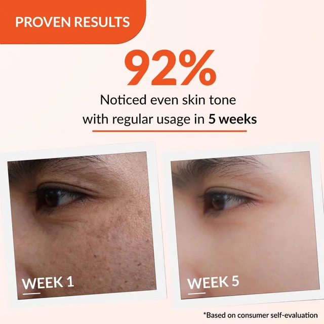 Fixderma Skarfix-TX Pigment Correcting Face Cream 30gm for Men & Women with Tranexamic Acid + 2% Kojic Acid + 1% Arbutin | Pigmentation, Dark Spots, Uneven Skin Tone Cream