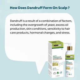 Indus Valley Anti-Dandruff Shampoo 200ml with Rosemary Oil | Helps Control Flakes & Soothe Itchy Scalp | Supports Hair Fall Defense, Scalp Care & Healthy-Looking Hair
