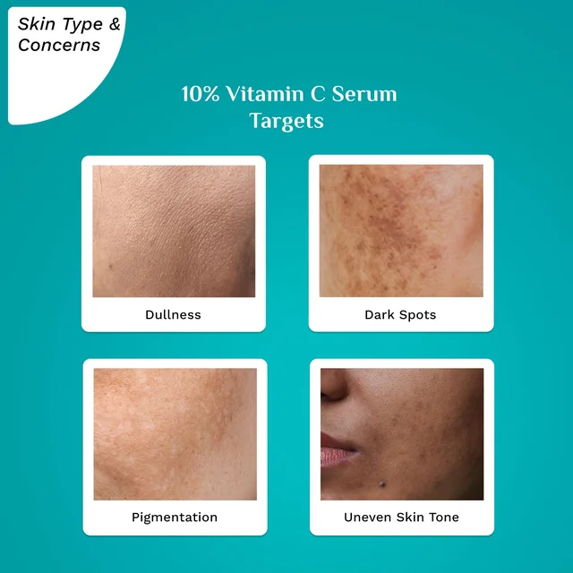 Pilgrim 10% Vitamin C Face Serum - 30ml | With 5% Niacinamide & Kakadu Plum | For Daily Brightness | Reduces Dark Spots & Evens Skin Tone | Glowing & Bright Skin | Fragrance Free | Fine Line Reduction | For All Skin Types