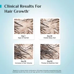 Pilgrim 3% Redensyl & 4% Anagain Advanced Hair Growth Serum 25ml Roll-On | Korean Black Rice Scalp Treatment | Controls Hair Fall, Boosts Regrowth & Density