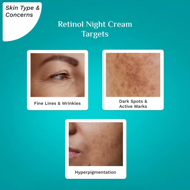 Pilgrim Retinol Night Cream-50g | with Vitamin C & Hyaluronic Acid | Youthful & Rejuvenated Skin | Reduce Wrinkles | Brightens & Evens Skin Tone | Lightweight & Non-Greasy | Improve Acne Scars | Collagen-boosting | Radiant skin | For All Skin Types