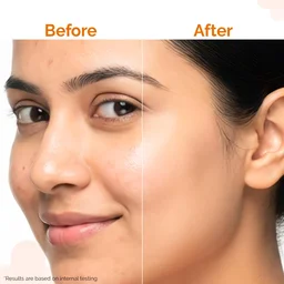 The Derma Co Pore Minimizing Priming Sunscreen 50g SPF 50 PA+++ | For Open Pores | Smooth Priming Texture | Broad Spectrum UVA/UVB Protection | Daily Face Sunscreen