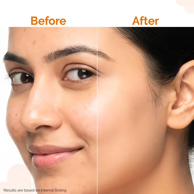 The Derma Co Pore Minimizing Priming Sunscreen 50g SPF 50 PA+++ | For Open Pores | Smooth Priming Texture | Broad Spectrum UVA/UVB Protection | Daily Face Sunscreen