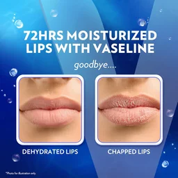 Vaseline Lip Therapy Original Lip Balm 7g | Classic Balm for Soft & Smooth Lips | Up to 72Hr Moisturization | Original Neutral Fragrance | Daily Lip Care