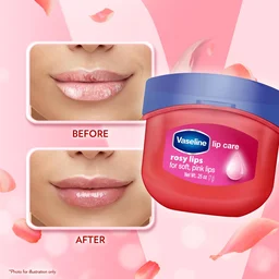 Vaseline Lip Therapy Rosy Lips Lip Balm 7g | Tinted Balm for Soft Pink Finish | Up to 72Hr Moisturization | Rosy Floral Fragrance | Daily Lip Care
