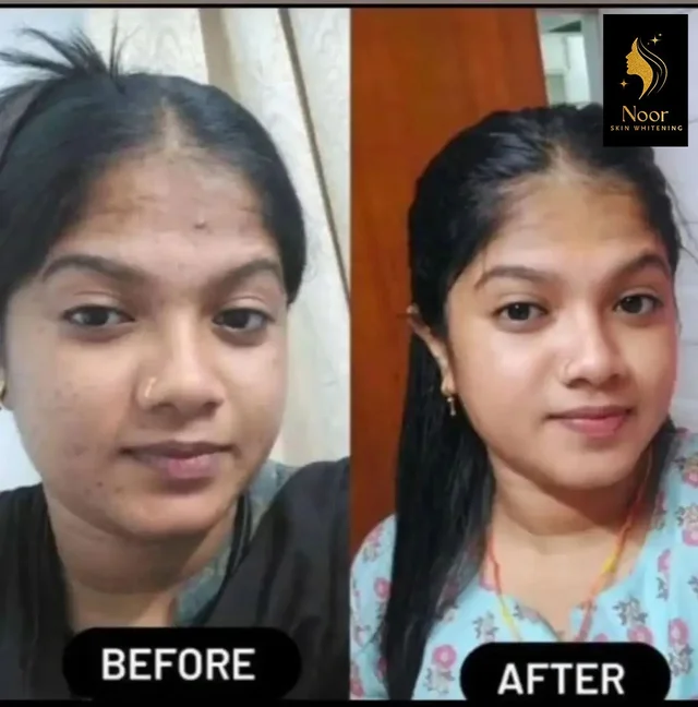Noor Skin Whitening Cream, Rice – Face Wash Combo