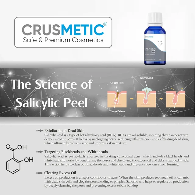 Crusmetic Salicylic Peel 15% - Advanced Acne Treatment Formula