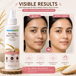 Mamaearth Rice Water Dewy Face Toner - 150 ML