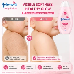 Johnson’s Baby Lotion - 200 ML