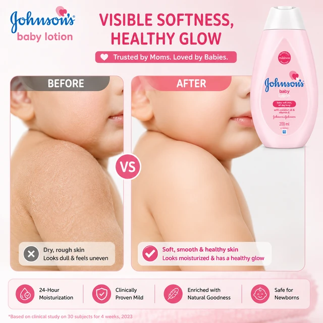 Johnson’s Baby Lotion - 200 ML