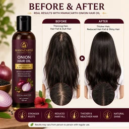 Mamaearth Onion Hair Oil - 150 mL