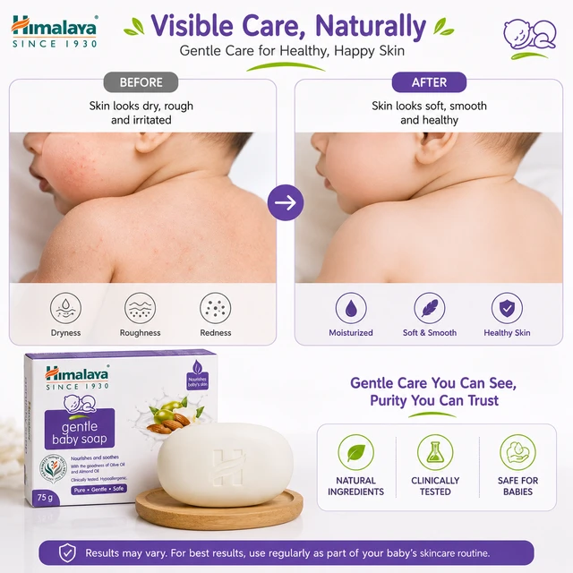 Himalaya Gentle Baby Soap - 75 G