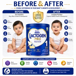 Nestle Lactogen Pro 1 - 400 g