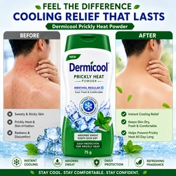 Dermicool Prickly Heat Powder - 75 g