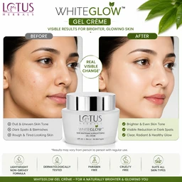 Lotus Herbals WhiteGlow Gel Creme - 50 G