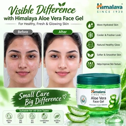 Himalaya Aloe Vera Face Gel
