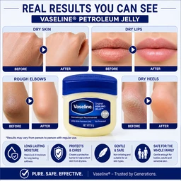 Vaseline Petroleum Jelly - 50 G