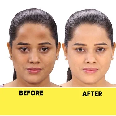 D-Tan Facial - starts at