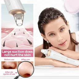 5 In 1 Multi-Function Blackhead Whitehead Extractor Remover Device Facial Cleansing Tool ,Skin Cleaner,Pimple Removal Tool,Acne Pimple Pore Cleaner Vacuum Suction Tool For Men & Women (5 in 1 Pro blackhead remover)