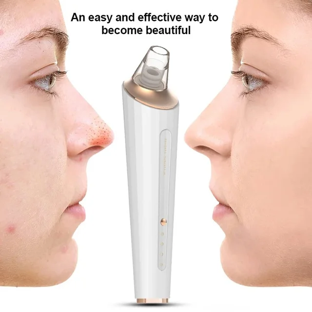 5 In 1 Multi-Function Blackhead Whitehead Extractor Remover Device Facial Cleansing Tool ,Skin Cleaner,Pimple Removal Tool,Acne Pimple Pore Cleaner Vacuum Suction Tool For Men & Women (5 in 1 Pro blackhead remover)